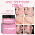 pimple cream for men acne cream